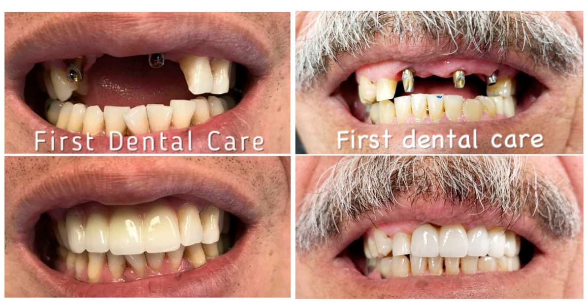 First Dental Care