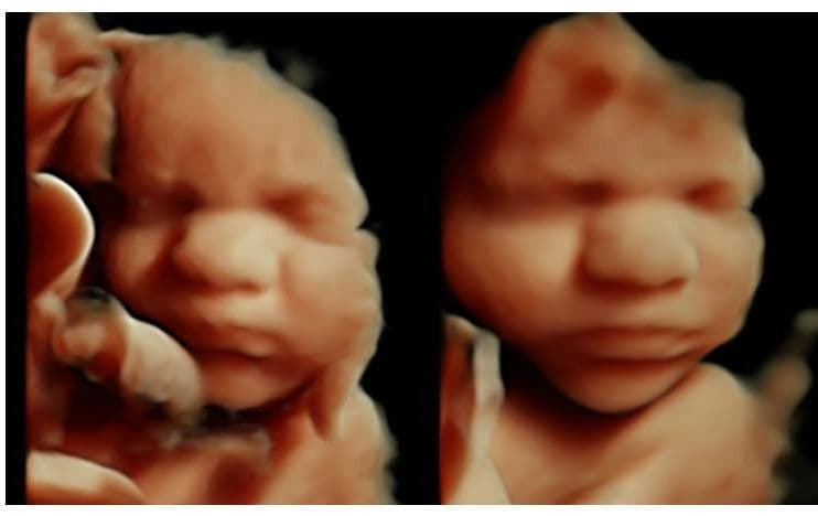 O My Baby Ultrasound Llc